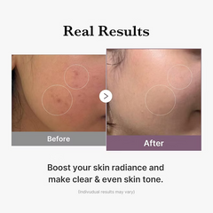Medicube - Age-R Glutathione Glow Toner