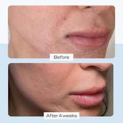 First Aid Ultra Repair Cream Intense Hydration