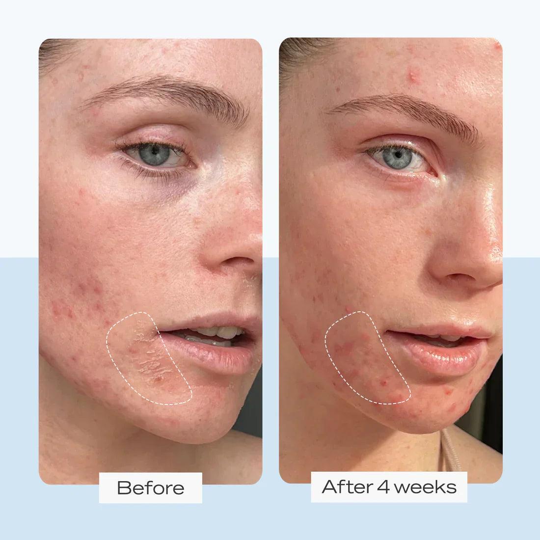 First Aid  Ultra Repair Cream Intense Hydration
